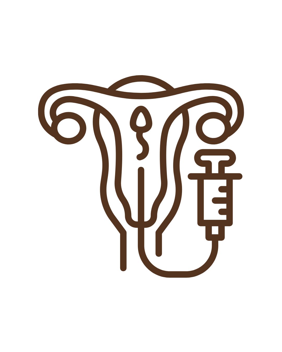 Inseminação intrauterina 